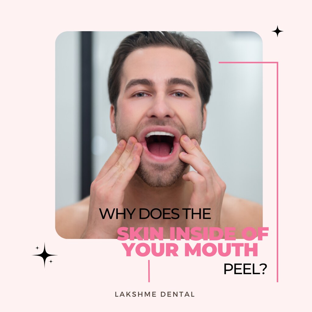 Why does the skin inside of your mouth peel? We usually ne… Flickr