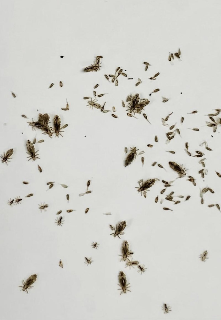 Lice Eggs, Casings (nits), and Live Lice Lice Centers of WI Flickr