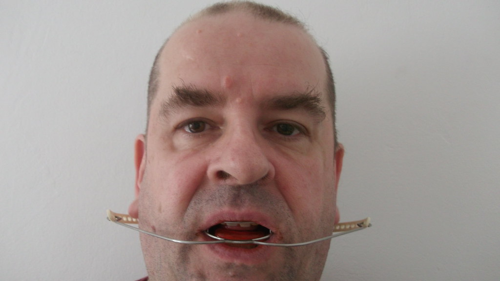 My NewGear Ortho cervical headgear 4 retainerfan Flickr