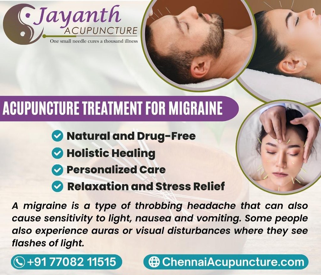 acupunctureTreatmentForMigraine Chennai Jayanth Acupuncture Flickr