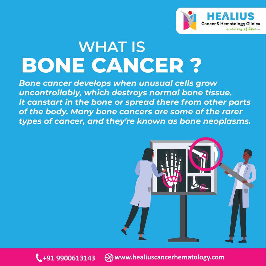 Bone cancer treatment in Bangalore Discover advanced bone … Flickr