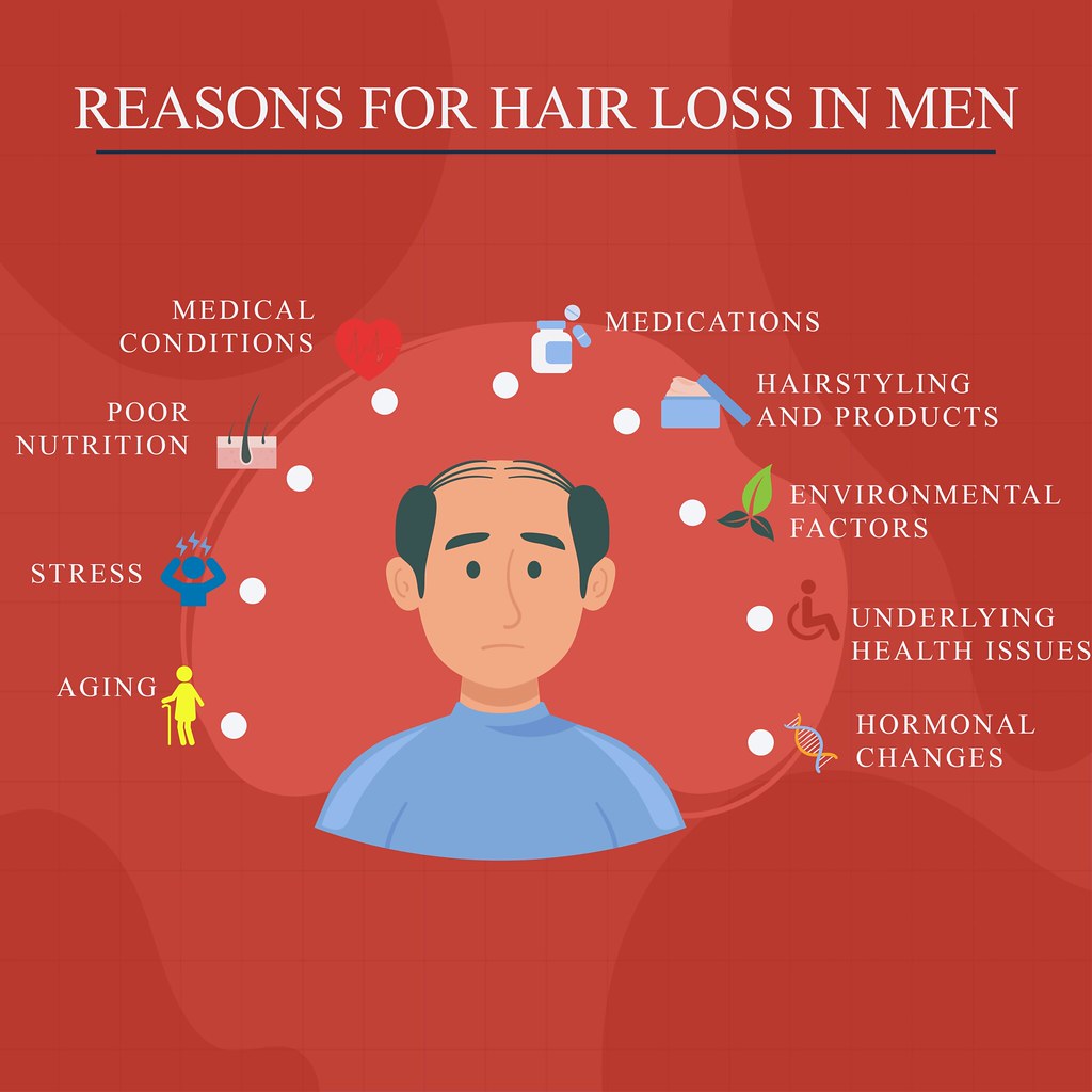 Top Causes of Hair Loss in Men Hair loss in men can result… Flickr