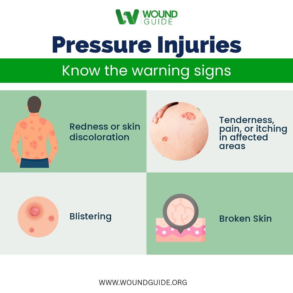Pressure Injuries Warning Signs You Shouldnt Ignore Flickr