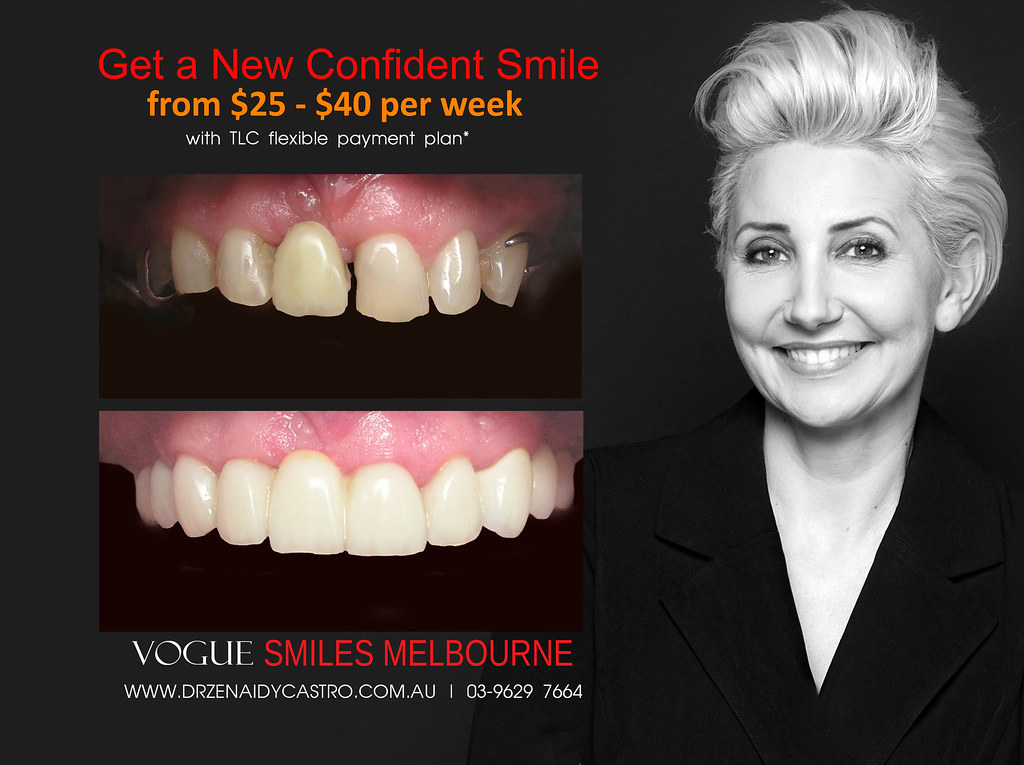 Cosmetic dental procedures and services, treatment options… Flickr