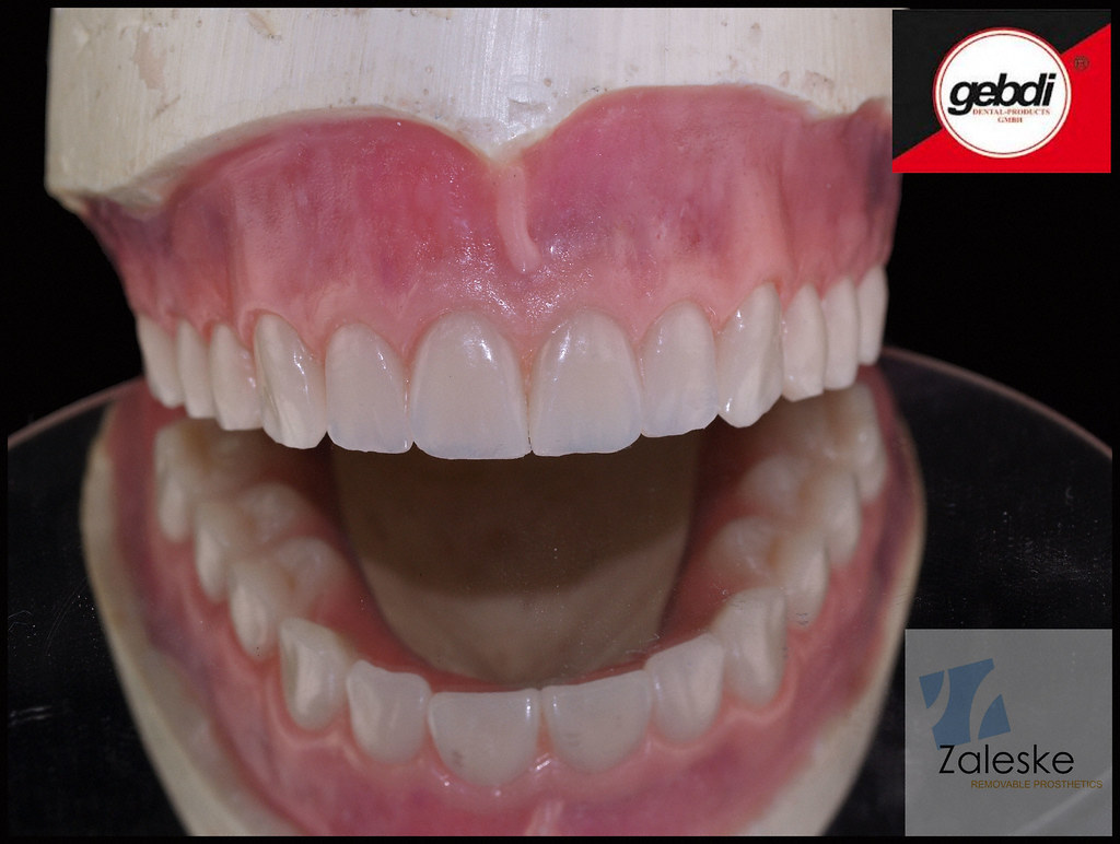 Gebdi Products Wax denture tryin evaluation using Gebdi T… Flickr