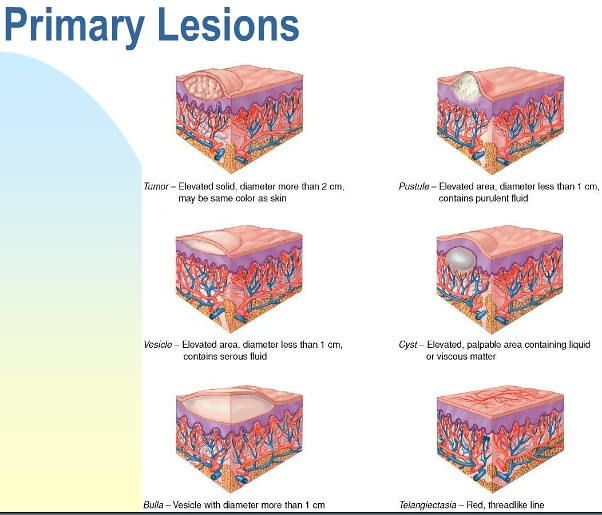Lesioni cutanee primarie 2 Lesioni dermatologiche della pe… Flickr