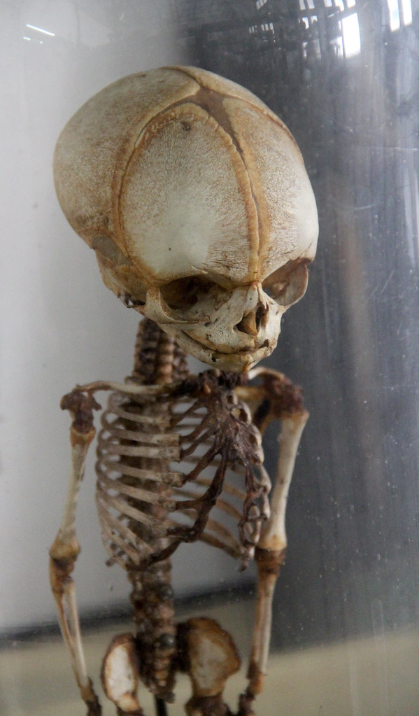 Fetal Skeleton, detail At the incredible Congdon