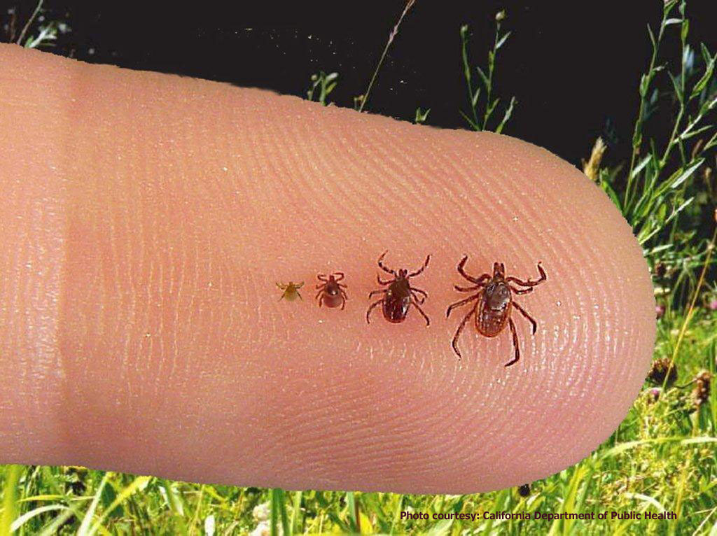 Ticks on Finger Blacklegged ticks are quite small and coul… Flickr