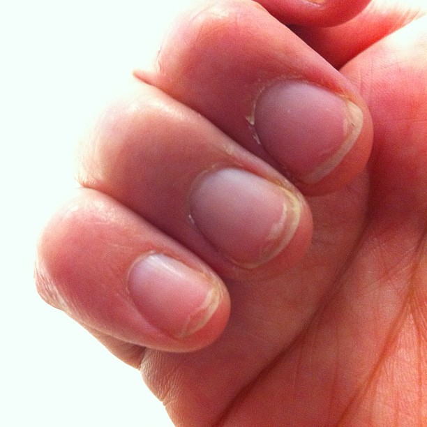 Zoya polish ruined my nails, they have never split like th… Flickr