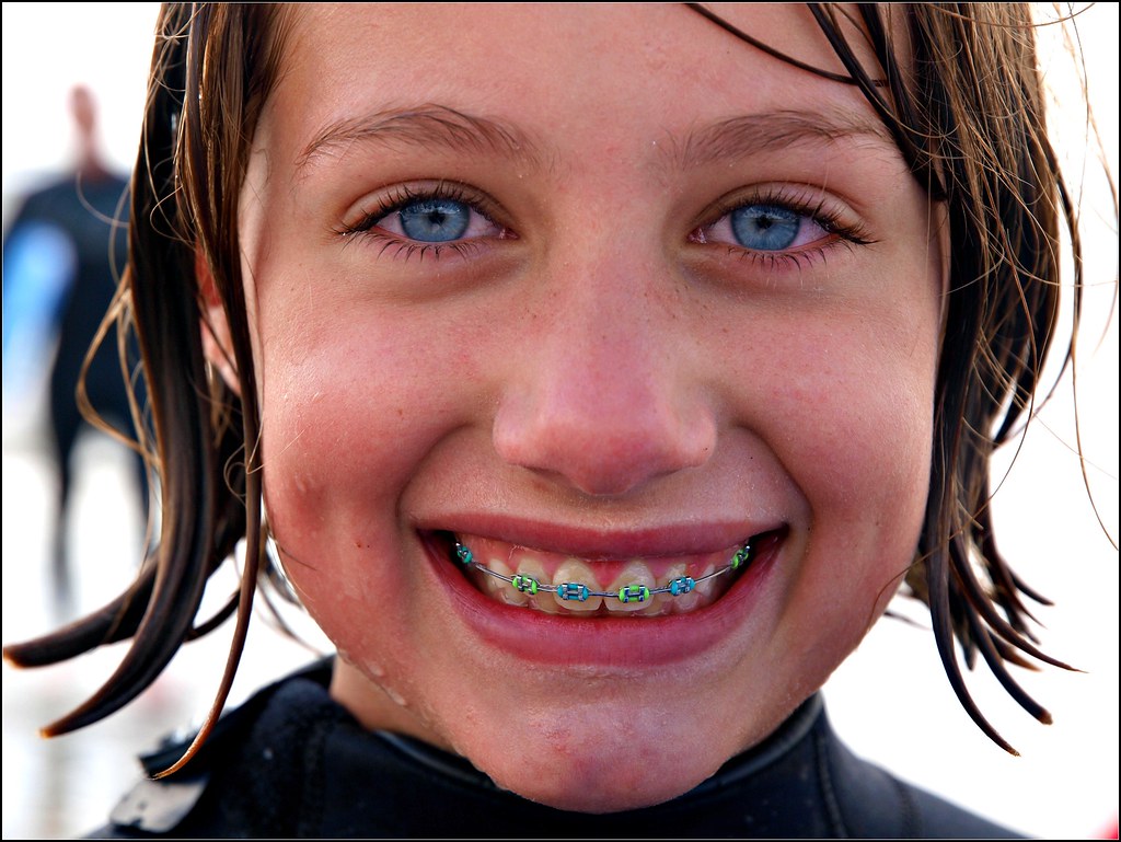Blue eyes and braces a photo on Flickriver