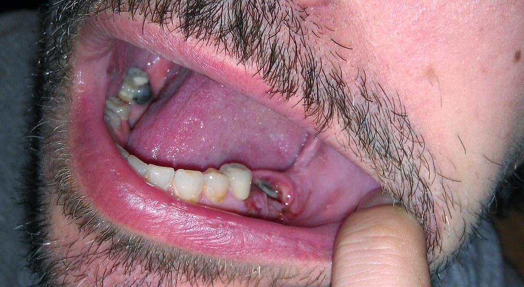 20111118 hanging out Clint minus tooth 19, bit of 18 sticking out