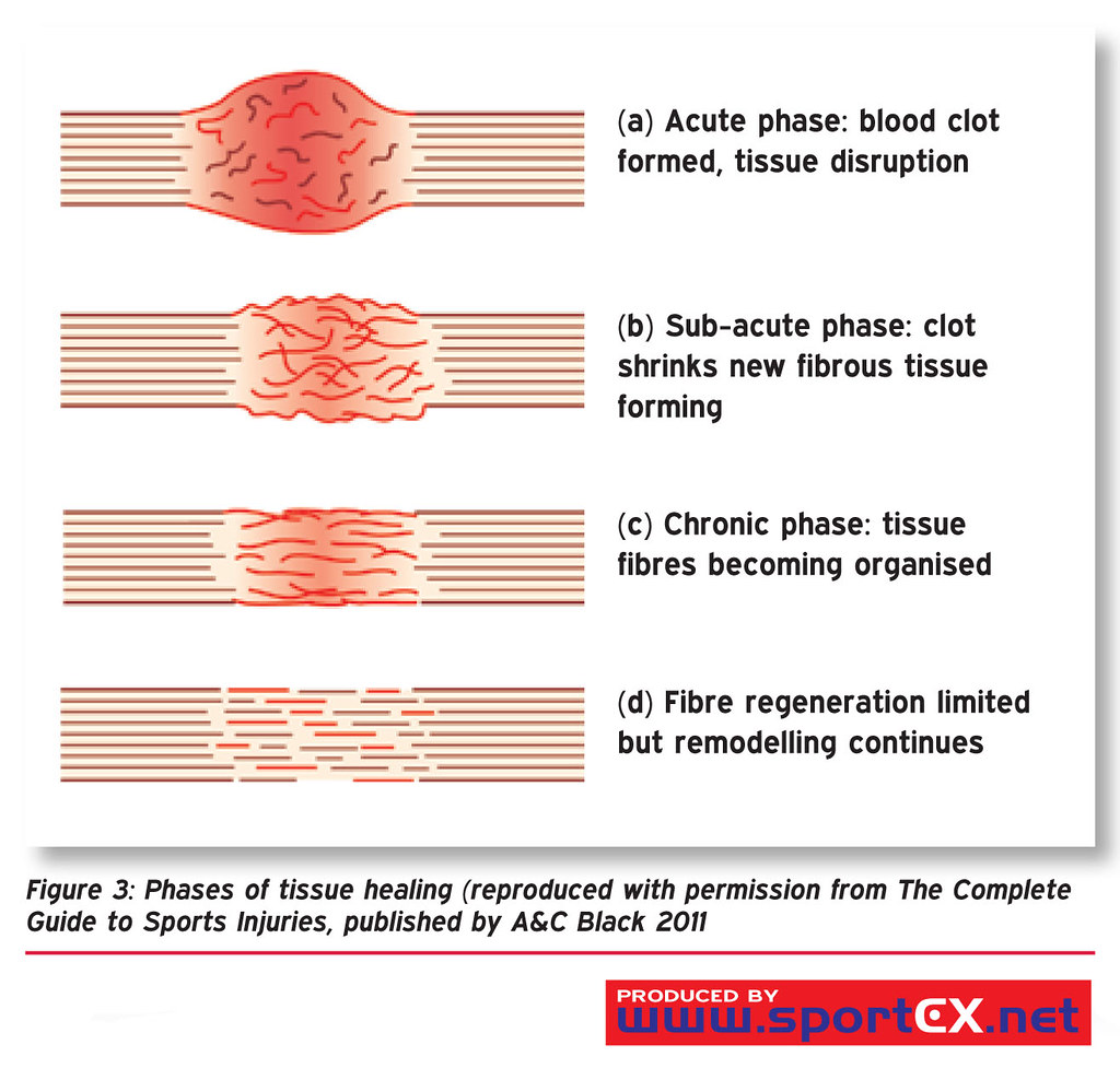 Phases of tissue healing (reproduced with permission from … Flickr