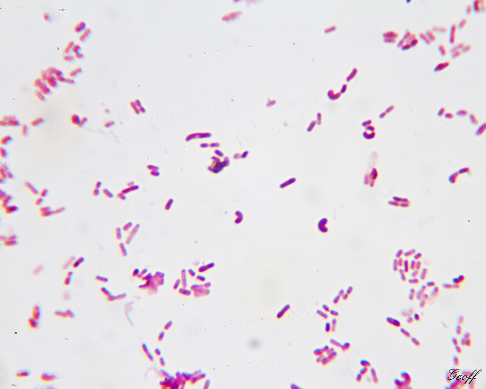 Vibrio In the image you will see a number of comma