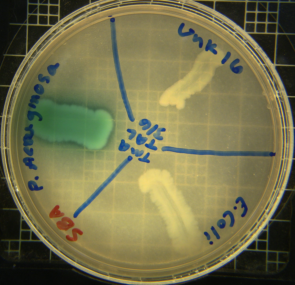 Spirit Blue Lipase Test
