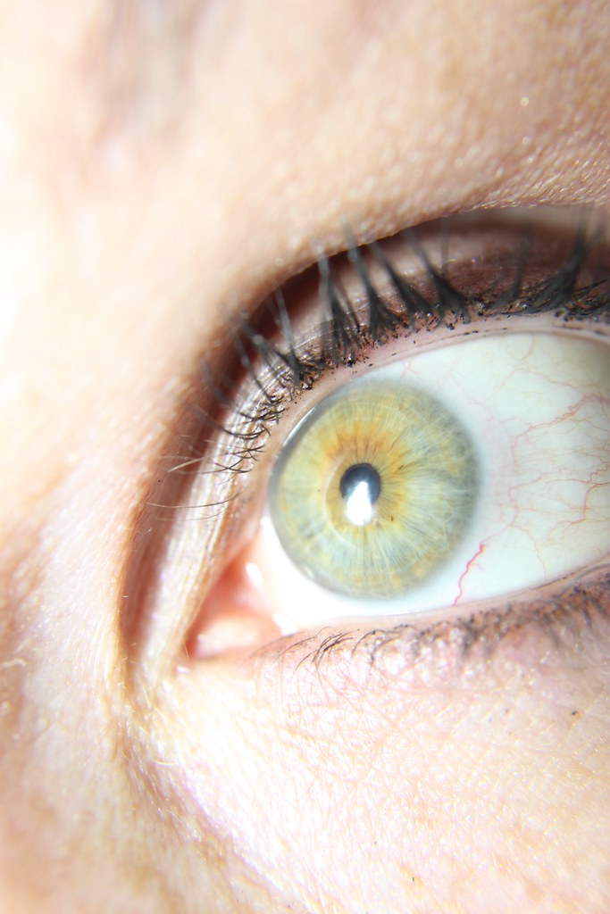 IMG_0186 Central Heterochromia, green eye with orange/gold… Flickr
