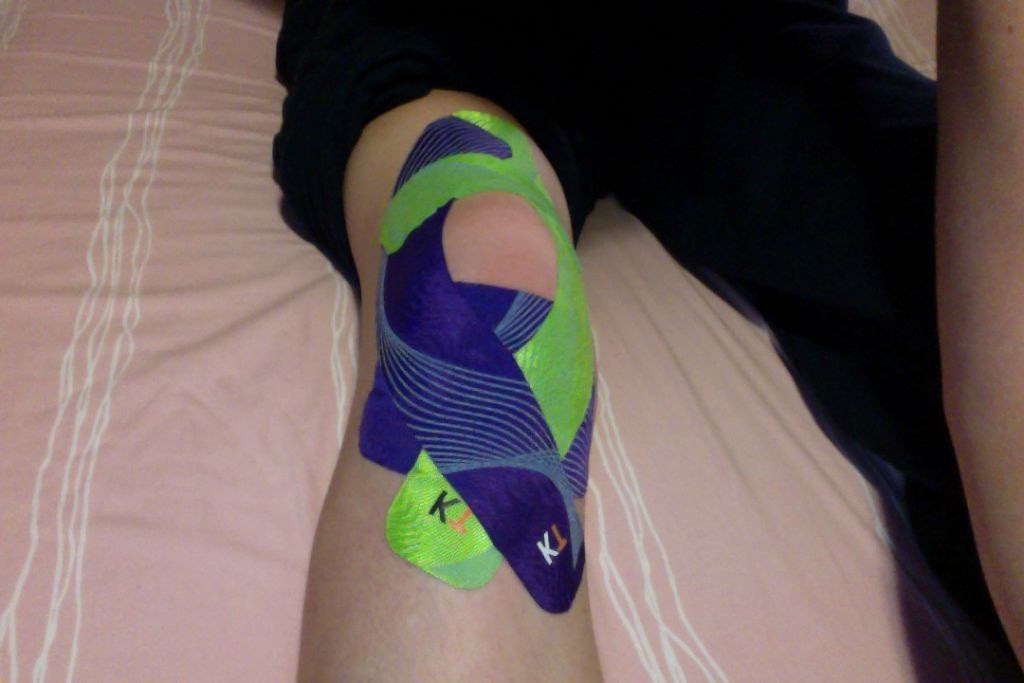 Knee Taping For Patellar Dislocation