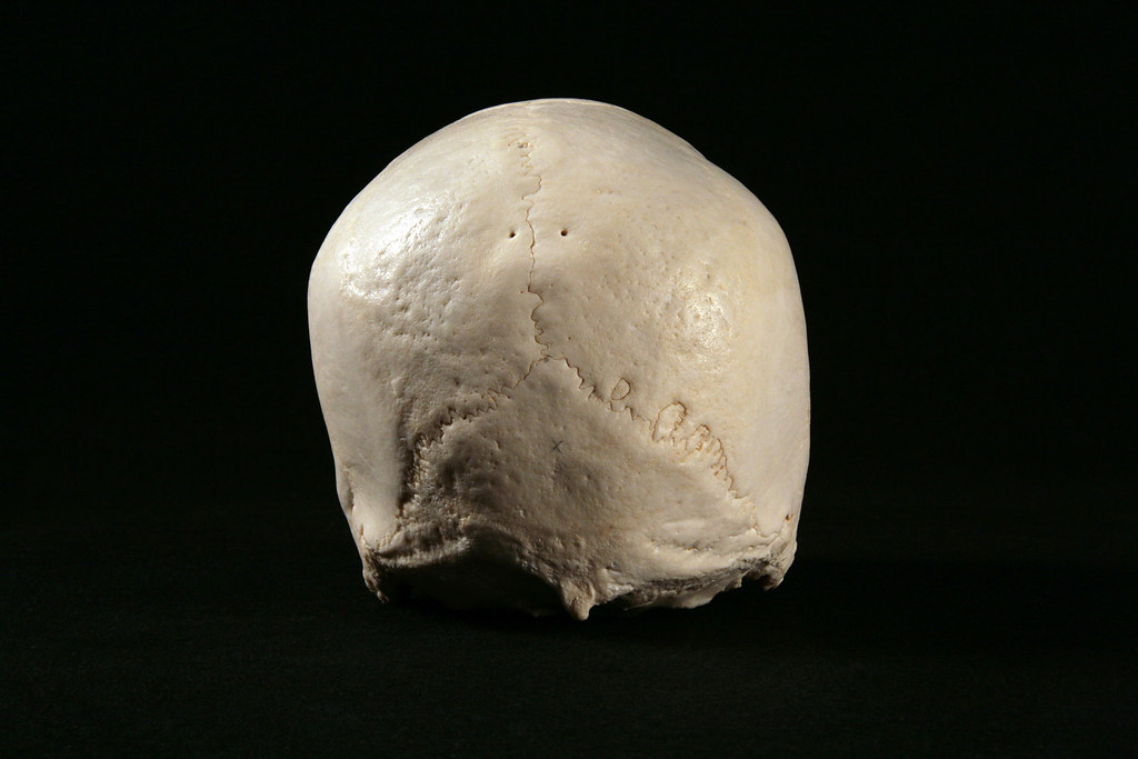 Forensics_Human_Skull_specimen_L_004.jpg For a 360degree … Flickr