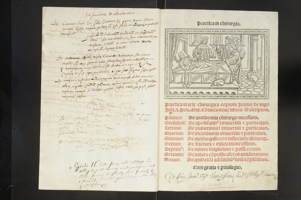 GIOVANNI DA VIGO (14601525) Practica in arte chirurgica … Flickr