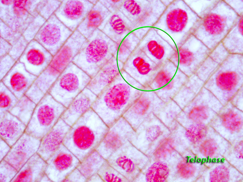 Plant Cell In Interphase Under Microscope Micropedia