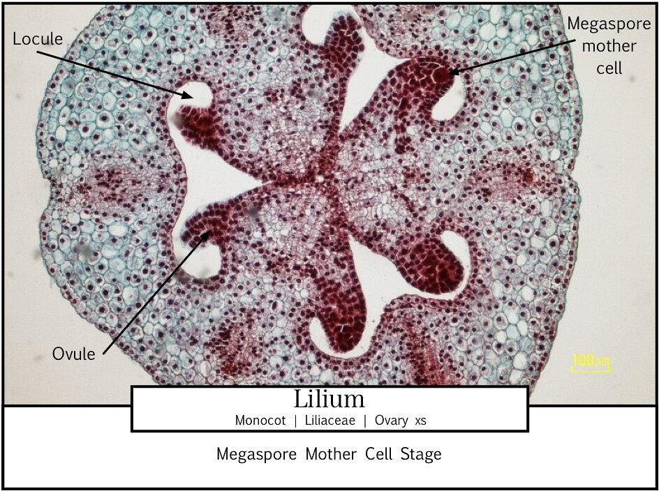 Lily Ovary Cross Section Labeled
