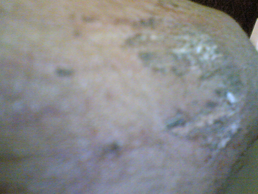 elbow clean clean elbow healed elbow having absorbed all t… Flickr