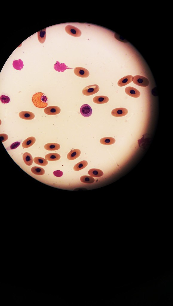 Turtle blood, heterophil, lymphocyte, and red blood cells Flickr
