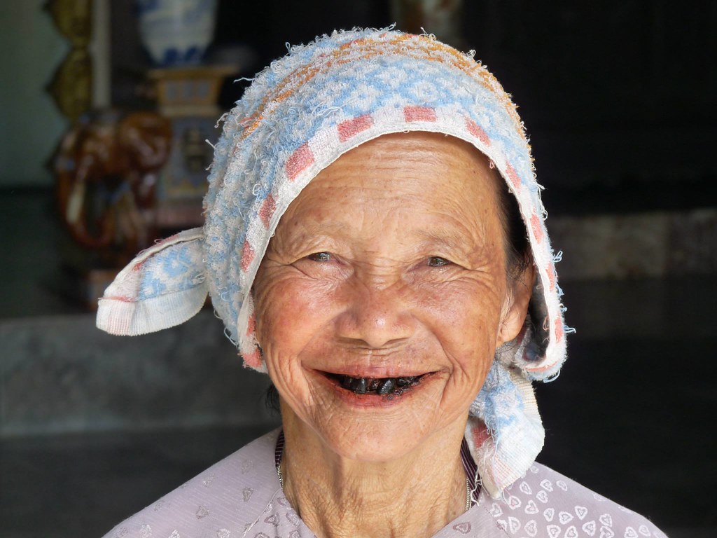 Black teeth as a sign of beauty.. Lu women dye their teeth… Flickr