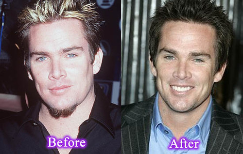 Mark Mcgrath Plastic Surgery Picture | You Can Download Mark… | Flickr