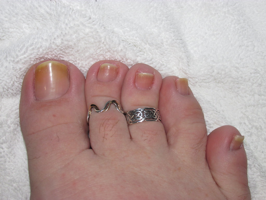 Between Colors These are what my toes look like when there… Flickr