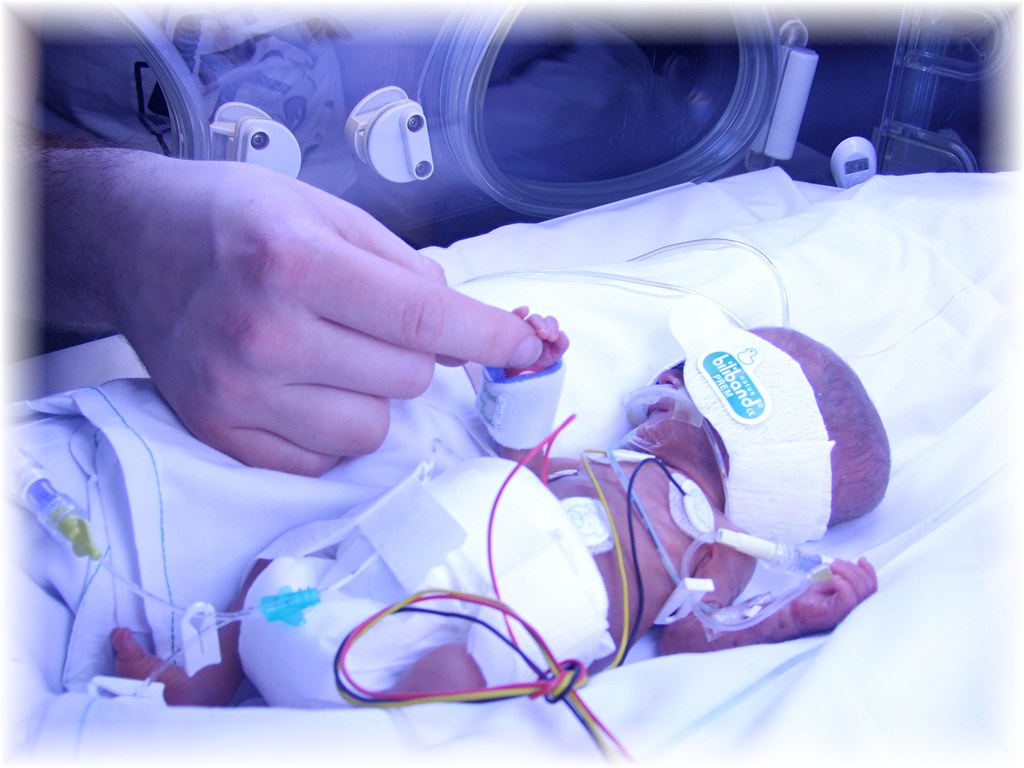 Layla our Little Miracle Layla at 48 hours old. She now
