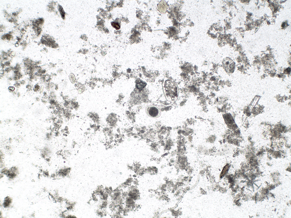 Hookworm x10mag UK NEQAS Set of parasite microscopic image… Flickr