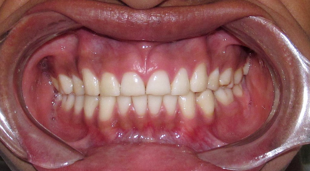 IMG_0317[1] FRANZ RODRIGUEZ. Flickr