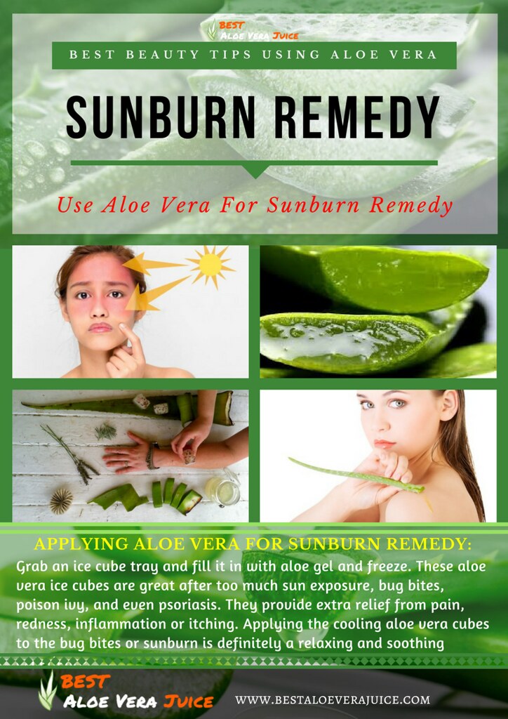 SUNBURNREMEDY BEST BEAUTY TIPS USING ALOE VERA Aloe vera … Flickr
