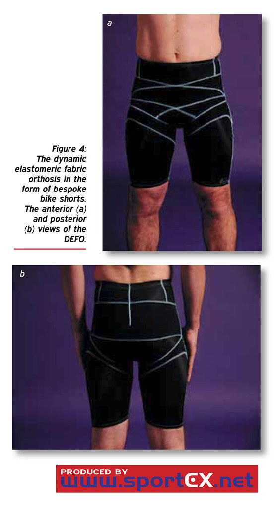 The dynamic elastomeric fabric orthosis in the form of bes… Flickr