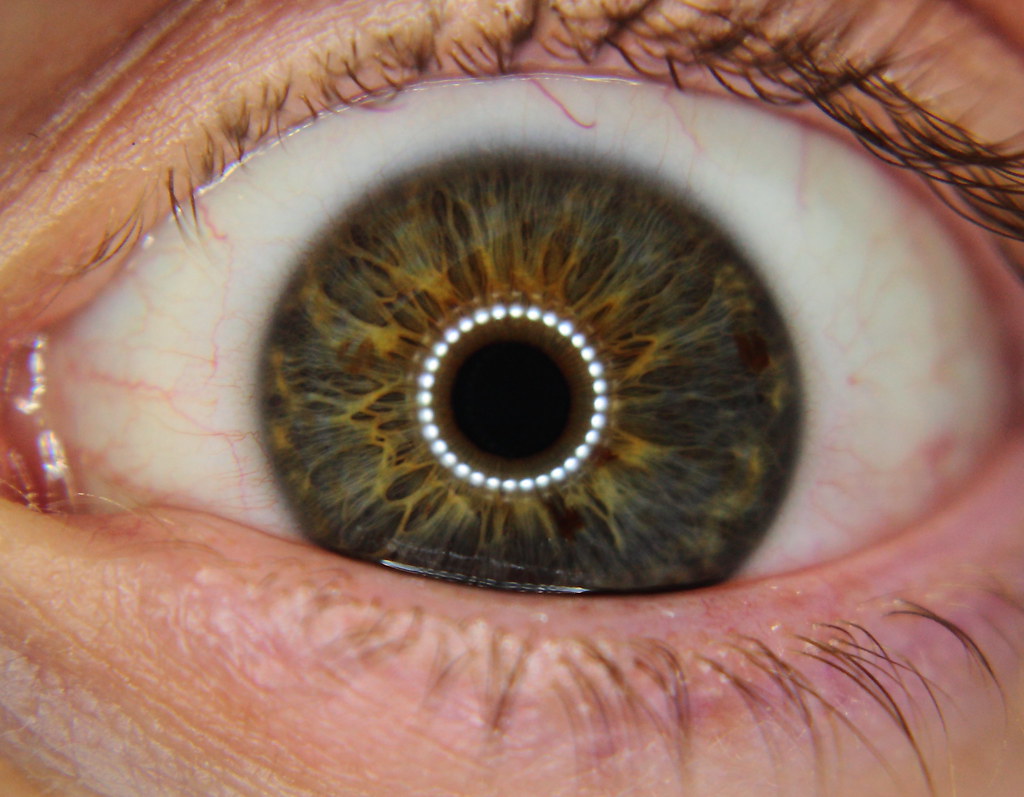 Eye Light. Reflection of macro ring light. William Dearie Flickr