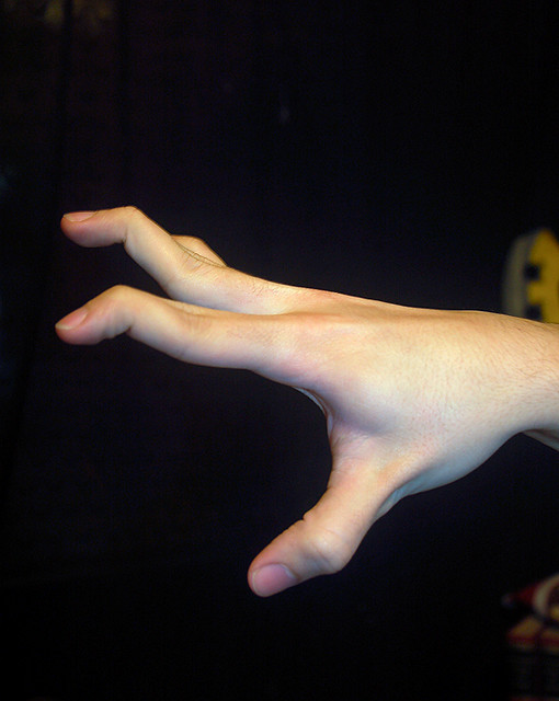 My brother´s hypermobile fingers Joint Hypermobility Syndrome Flickr