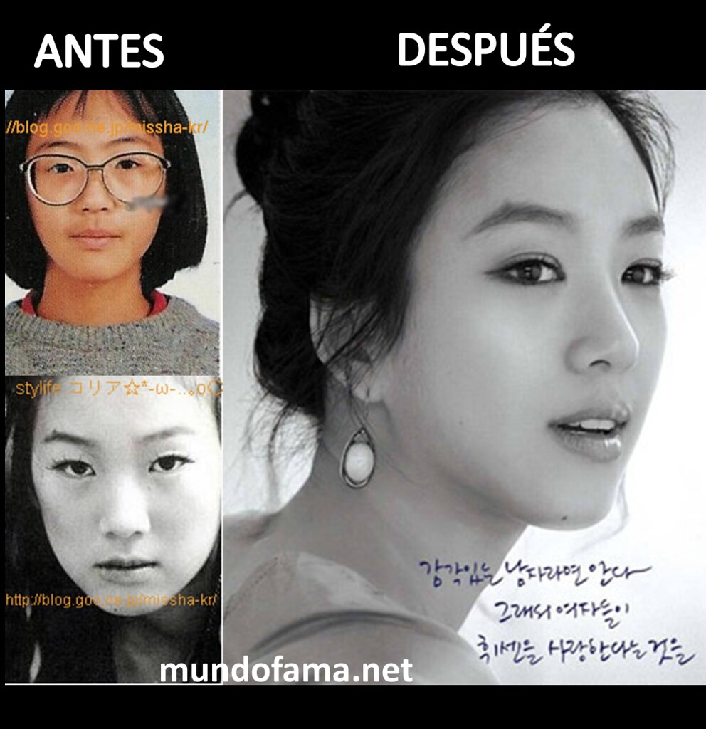 KOREAN ACTRESS BEFORE AND AFTER PLASTIC SURGERY ACTRICES C… Flickr