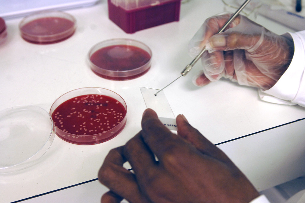 06410063 The bacteria are spread on a glass microscope sli… Flickr