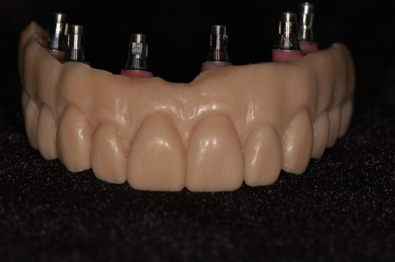 WaxUps Studio32 Dental Laboratory