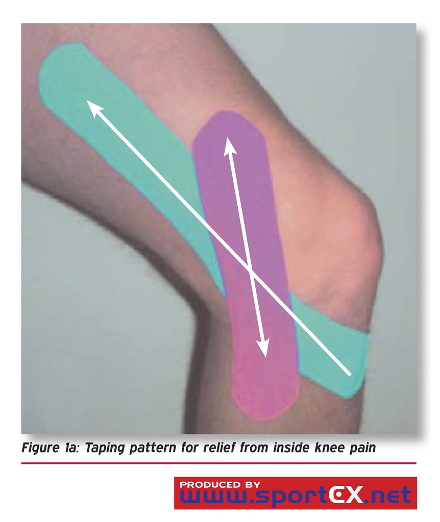Taping pattern for relief from inside knee pain sportEX journals Flickr