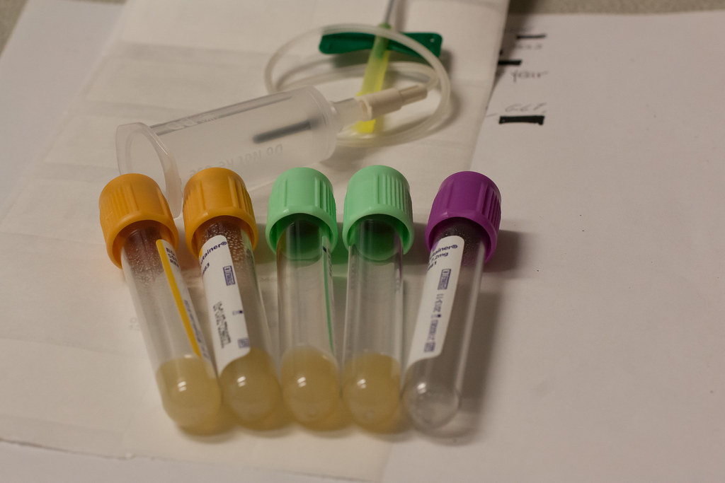 Monthly blood test time (CC) Phillip Jeffrey. www.fadetopl… Flickr