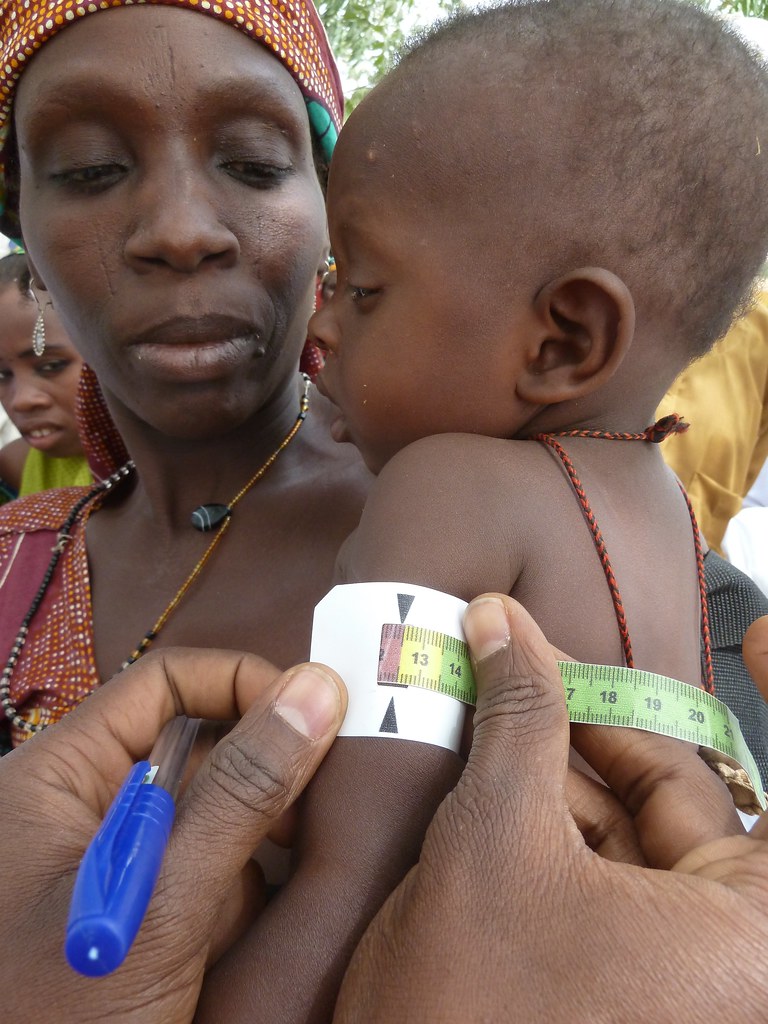 A child is checked for signs of malnutrition in Katsina St… Flickr