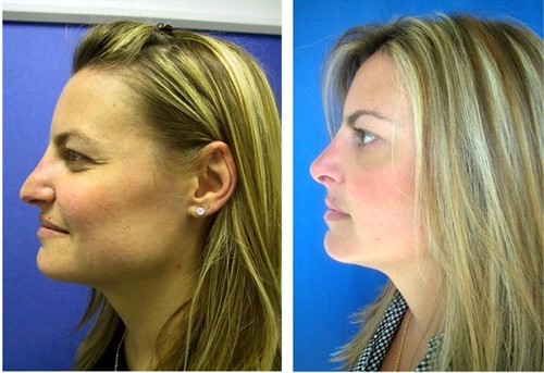 cosmetic surgery beverly hills Board Certified plastic sur… Flickr