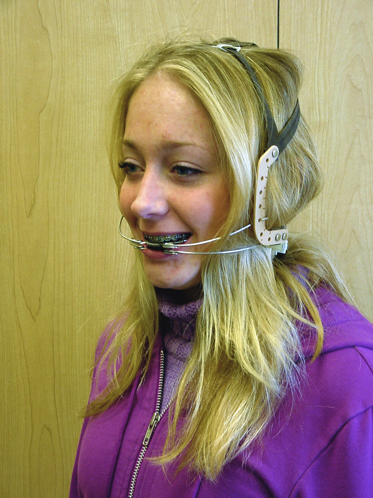 Stacy in Braces (14) Clive C Ingram Flickr