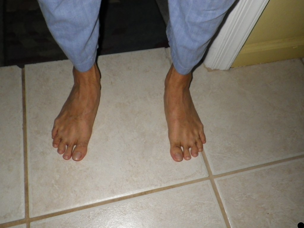 October 1, 2013 My feet osseous Flickr