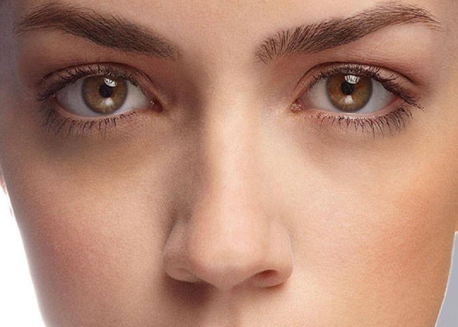 Under Eye Dark Circles Treatment in Delhi Under eye dark c… Flickr