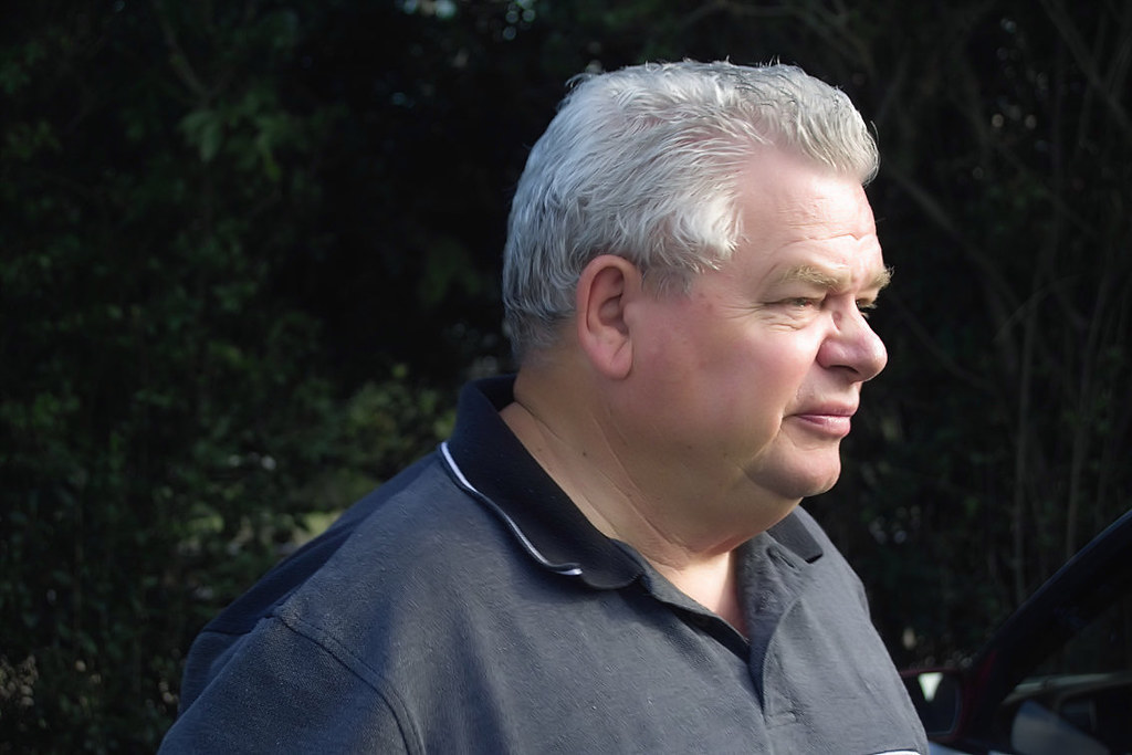 PawPaw Miller Blind in one eye. Vision impaired in the oth… Flickr