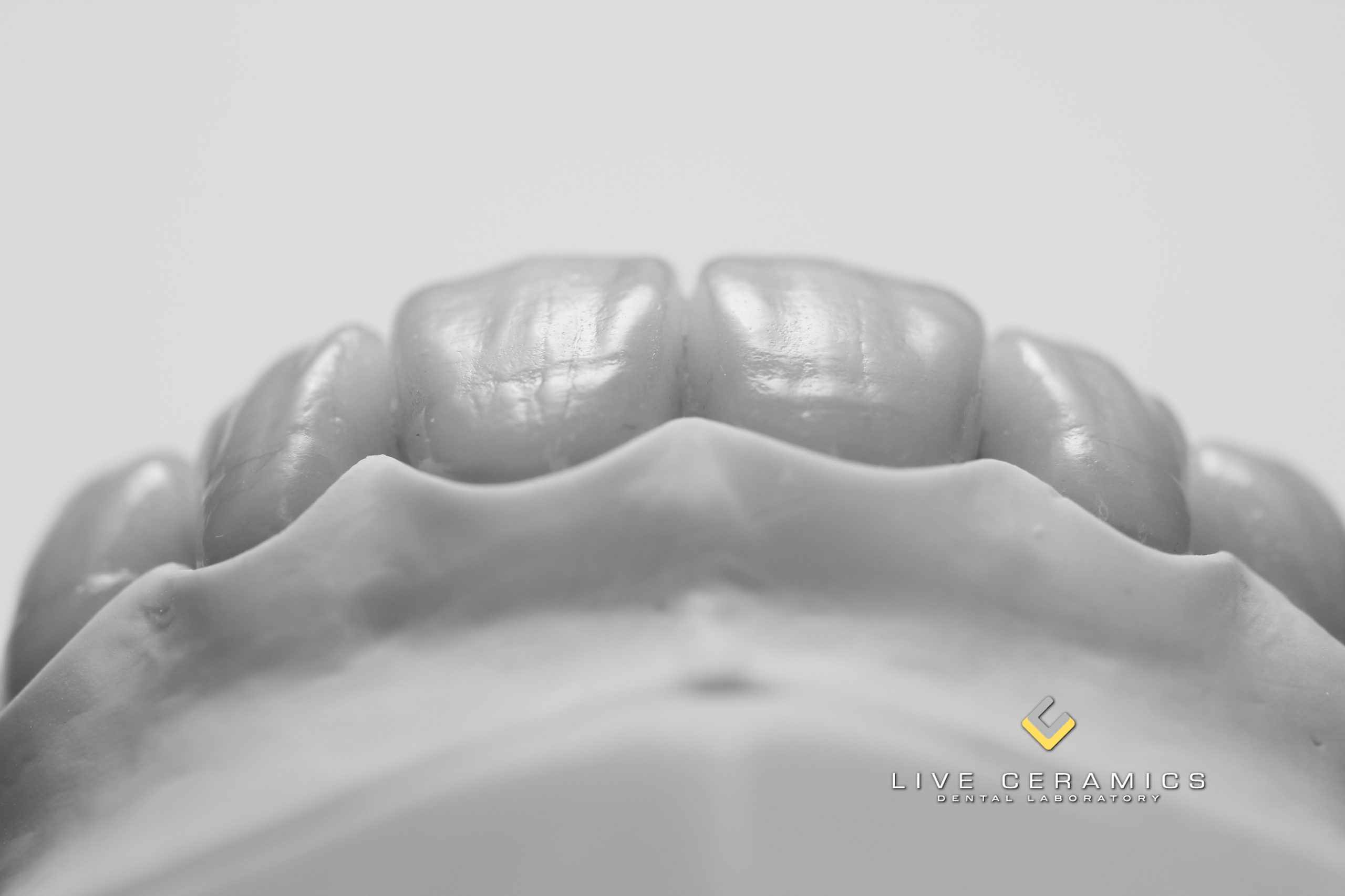 Live Ceramics Dental Laboratory