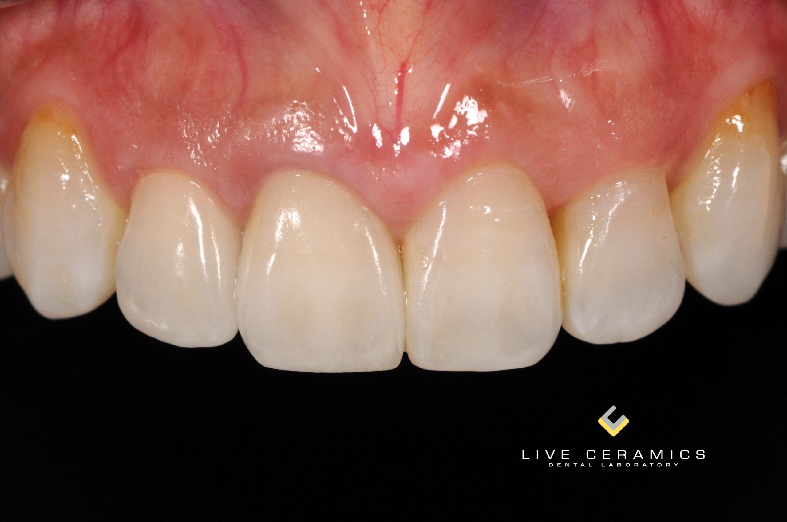 Live Ceramics Dental Laboratory