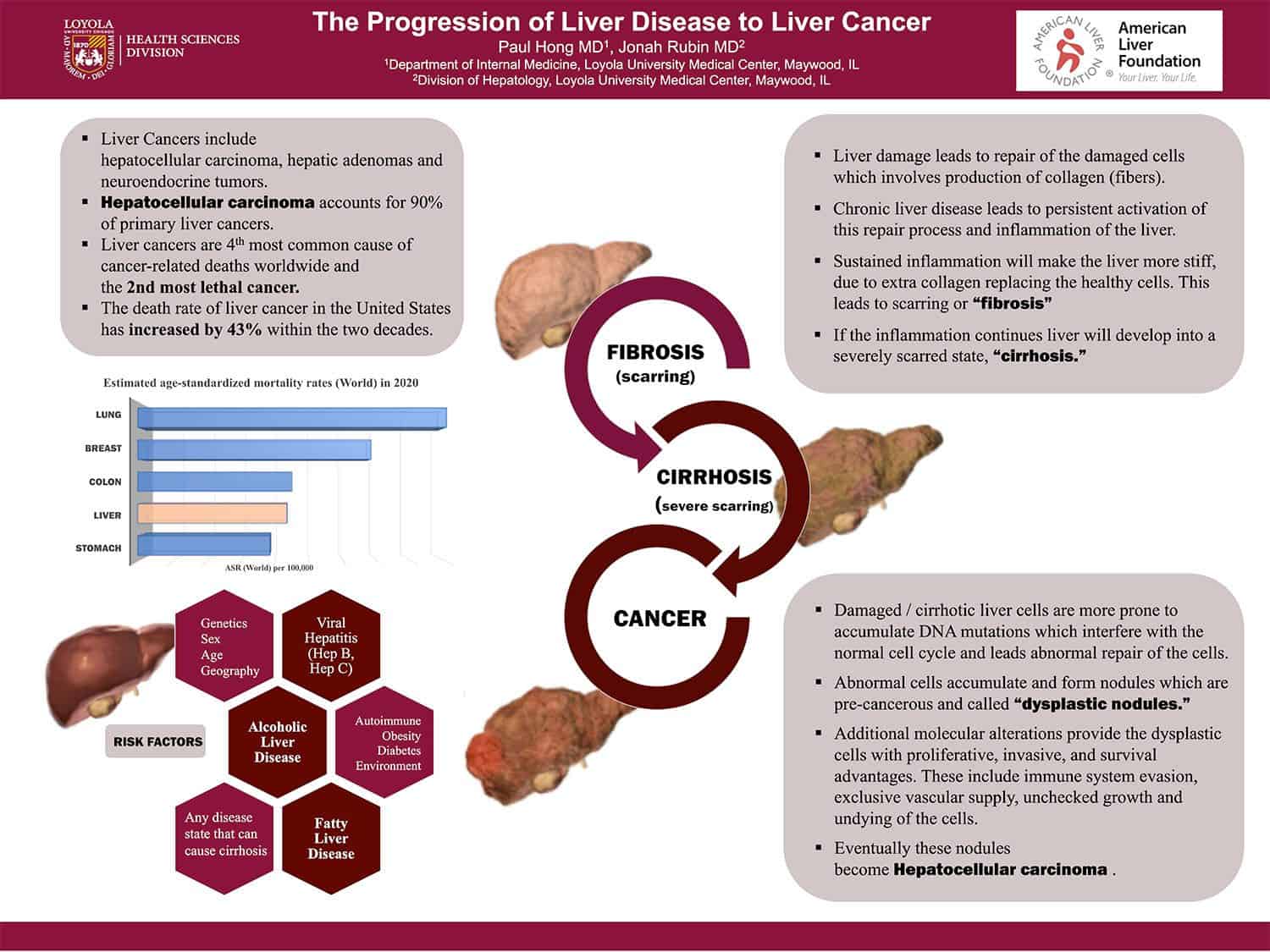 The Progression of Liver Disease to Liver Cancer American Liver